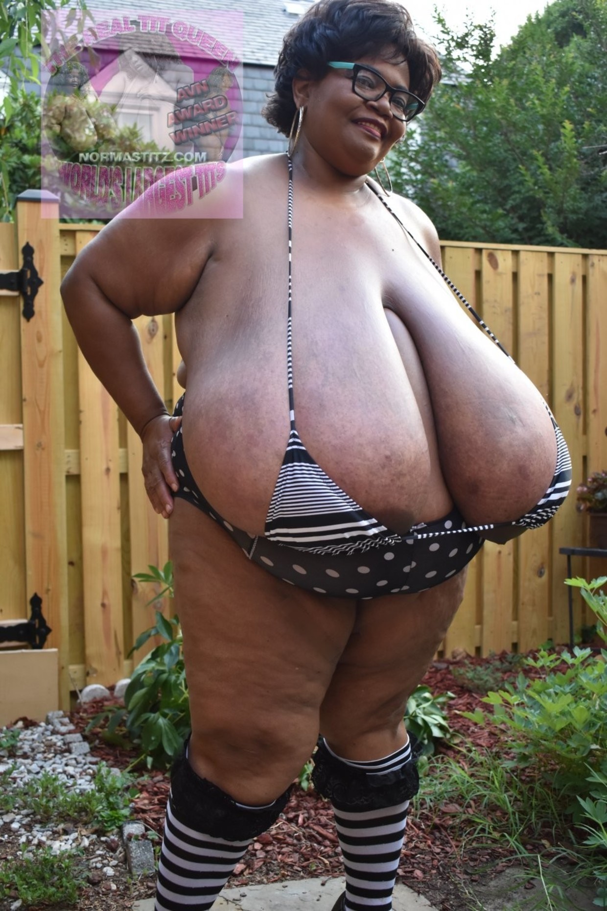 Norma stitz tube